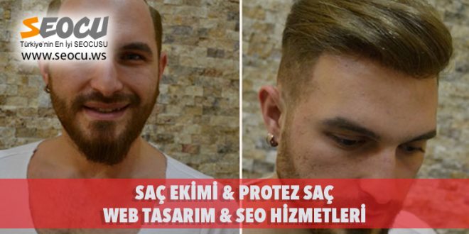 Saç Ekimi & Protez Saç Web Tasarım & Seo Hizmetleri